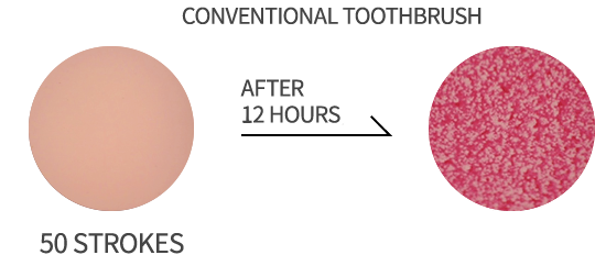 一般の歯ブラシ